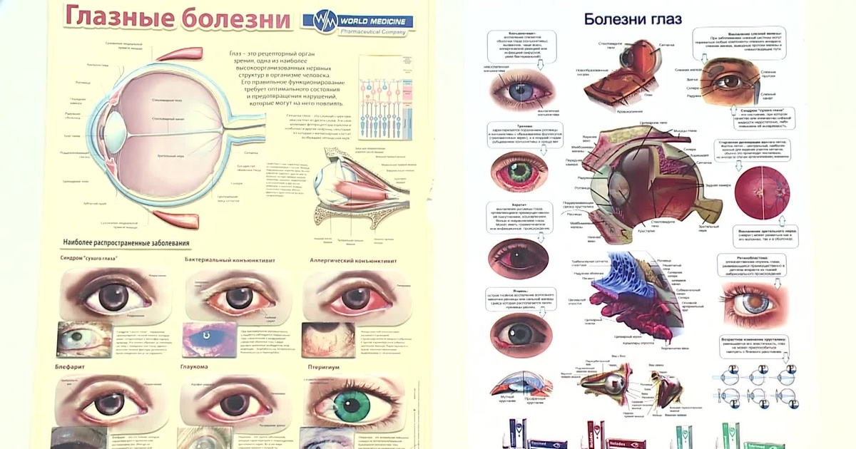 37 мың бала көз ауруына шалдыққан