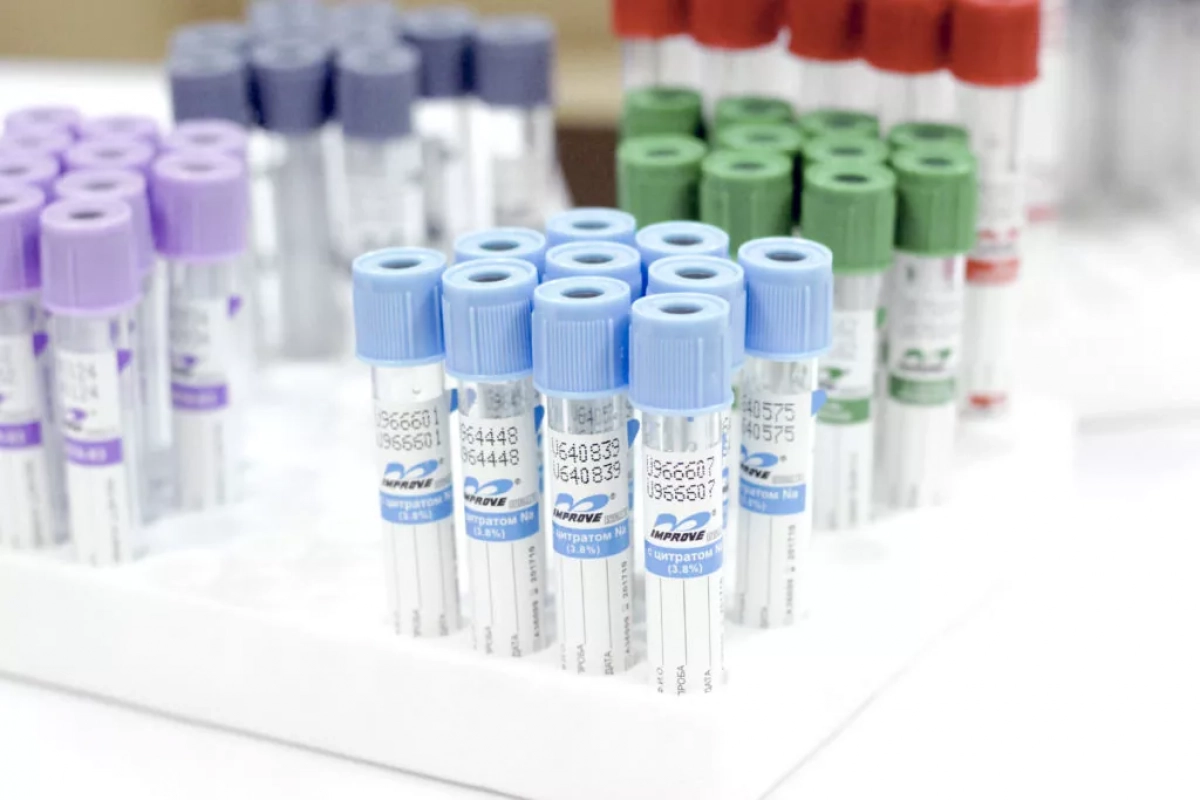 ШЫМКЕНТТІК ВАКУУМДЫ ПРОБИРКАЛАР СҰРАНЫСҚА ИЕ