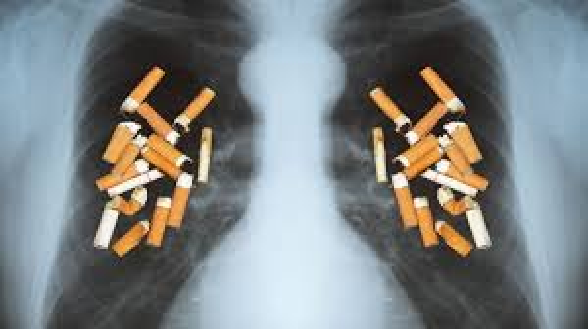 ТЕМЕКІ ШЕГУДІҢ ӘСЕРІНЕН ТУЫНДАЙТЫН АУРУЛАР